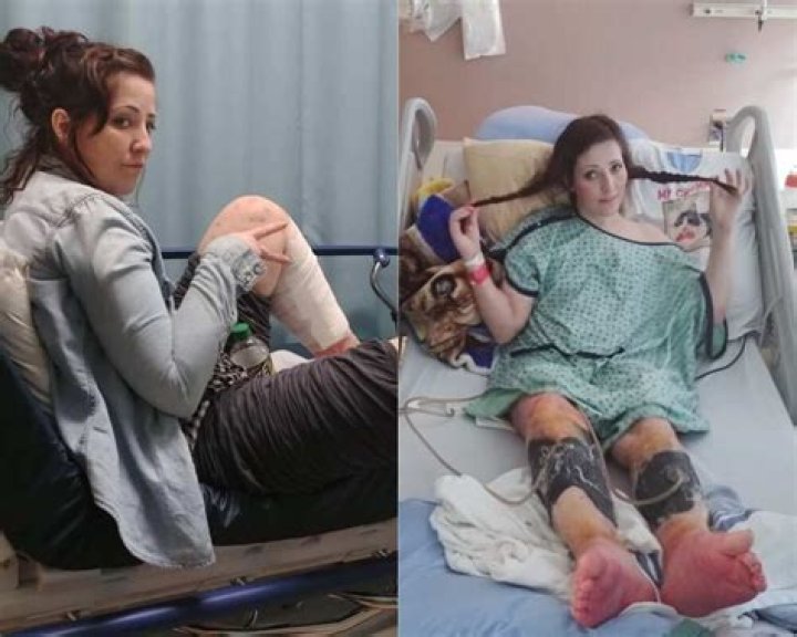 Kelly Ronahan's full story explained surgery and latest updates Tuko